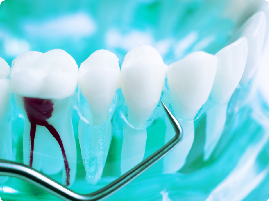 endodontie02 endodontie02
