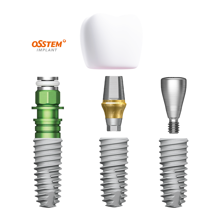 implant dentar