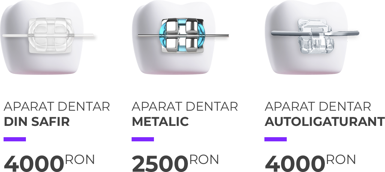 tarife-aparat-dentar